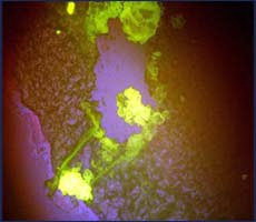 нанолюминофоры – светящиеся метки для стволовой клетки  