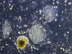 стволовые клетки могут продлить жизнь